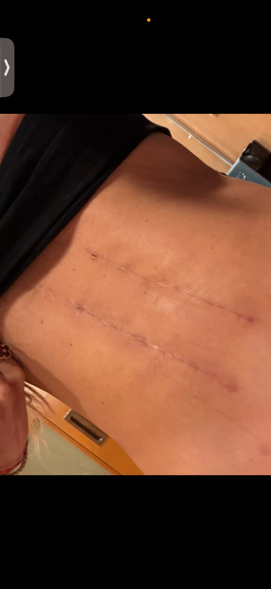 Before treatment